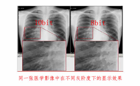 灰階顯示器使用上有什么注意點